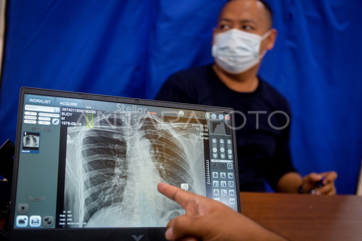 Skrining Cek Kesehatan Gratis di Indonesia